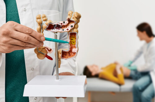 Understanding Crohn's Disease Symptoms, Diagnosis, and Treatment Options